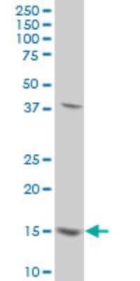 Western Blot: MED21 Antibody (2D9) [H00009412-M10] - Analysis of SURB7 expression in HeLa (Cat # L013V1).