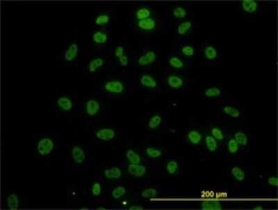 Immunocytochemistry/Immunofluorescence: MED21 Antibody (5A6) [H00009412-M04] - Analysis of monoclonal antibody to SURB7 on HeLa cell. Antibody concentration 10 ug/ml