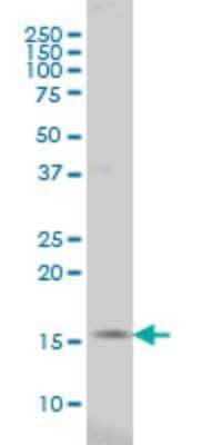 Western Blot: MED21 Antibody (5A6) [H00009412-M04] - Analysis of SURB7 expression in HeLa (Cat # L013V1).