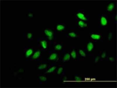 Immunocytochemistry/Immunofluorescence: MED21 Antibody (6B6) [H00009412-M03] - Analysis of monoclonal antibody to SURB7 on HeLa cell. Antibody concentration 10 ug/ml