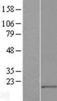 Western Blot: MED21 Overexpression Lysate (Adult Normal) [NBL1-12986] Left-Empty vector transfected control cell lysate (HEK293 cell lysate); Right -Over-expression Lysate for MED21.