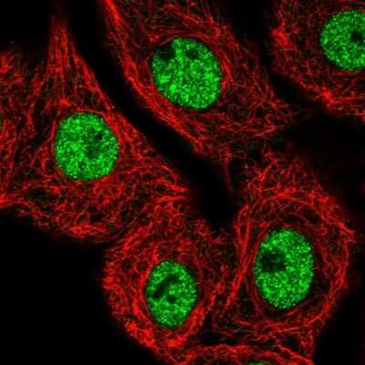 Immunocytochemistry/Immunofluorescence: MED25 Antibody [NBP2-55868] - Staining of human cell line A549 shows localization to nucleoplasm. Antibody staining is shown in green.