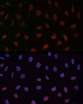 Immunocytochemistry/Immunofluorescence: MED25 Antibody [NBP3-04944] - Analysis of U-2 OS cells using MED25 antibody at dilution of 1:100 (40x lens). Blue: DAPI for nuclear staining.