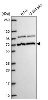 Western Blot: MED25 Antibody [NBP2-55868] - Analysis in human cell line RT-4 and human cell line U-251 MG.
