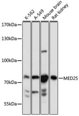 Western Blot: MED25 Antibody [NBP3-04944] - Analysis of extracts of various cell lines, using MED25 antibody at 1:1000 dilution. Secondary antibody: HRP Goat Anti-Rabbit IgG (H+L) at 1:10000 dilution. Lysates/proteins: 25ug per lane. Blocking buffer: 3% nonfat dry milk in TBST. Detection: ECL Basic Kit