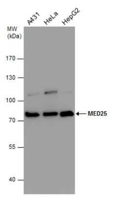 Western Blot: MED25 Antibody [NBP3-12909] - MED25 antibody detects MED25 protein by western blot analysis. Various whole cell extracts (30 ug) were separated by 7.5% SDS-PAGE, and the membrane was blotted with MED25 antibody (NBP3-12909) diluted at 1:1000.