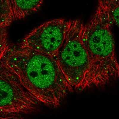 Immunocytochemistry/Immunofluorescence: MED26 Antibody [NBP2-57785] - Staining of human cell line MCF7 shows localization to nucleoplasm & vesicles.