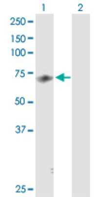 Western Blot: MED26 Antibody [H00009441-D01P] - Analysis of MED26 expression in transfected 293T cell line by MED26 polyclonal antibody.Lane 1: MED26 transfected lysate(65.40 KDa).Lane 2: Non-transfected lysate.