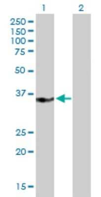 Western Blot: MED27 Antibody [H00009442-B01P] - Analysis of MED27 expression in transfected 293T cell line by MED27 polyclonal antibody.  Lane 1: CRSP8 transfected lysate(34.21 KDa). Lane 2: Non-transfected lysate.