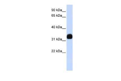 Western Blot: MED27 Antibody [NBP3-10307] - Western blot analysis using NBP3-10307 on Human Brain  as a positive control. Antibody Titration: 0.2-1 ug/ml