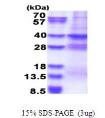 SDS-Page: MED27 Recombinant Protein [NBP2-51663] - 15% SDS Page (3 ug)