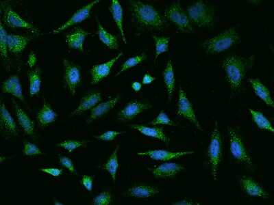 Immunocytochemistry/Immunofluorescence: MED28 Antibody [NBP2-97494] - Immunofluorescence staining of MED28 in HeLa cells. Cells were fixed with 4% PFA, permeabilzed with 0.1% Triton X-100 in PBS, blocked with 10% serum, and incubated with rabbit anti-Human MED28 polyclonal antibody (dilution ratio 1:200) at 4C overnight. Then cells were stained with the Alexa Fluor(R)488-conjugated Goat Anti-rabbit IgG secondary antibody (green) and counterstained with DAPI (blue).Positive staining was localized to Cytoplasm.