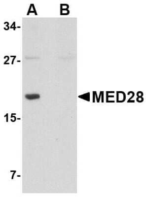 Western Blot: MED28 Antibody [NBP1-76931] - Human brain tissue lysate with MED28 antibody at 1 ug/mL in (A) the absence and (B) the presence of blocking peptide.