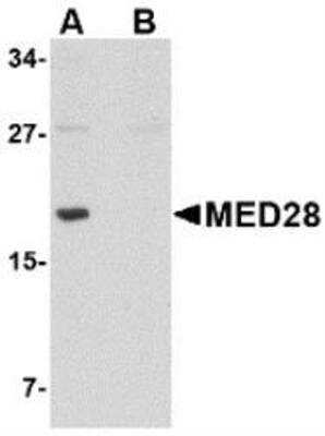 Western Blot: MED28 Peptide [NBP1-76931PEP] - blocks the antibody activity completely in Western blot by incubating the peptide with equal volume of antibody for 30 min at 37C.