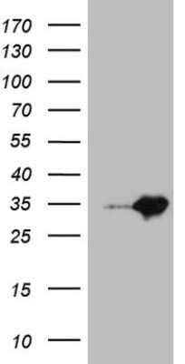 Western Blot: MED30 Antibody (OTI3B3) - Azide and BSA Free [NBP2-72619] - Analysis of HEK293T cells were transfected with the pCMV6-ENTRY control (Left lane) or pCMV6-ENTRY MED30.