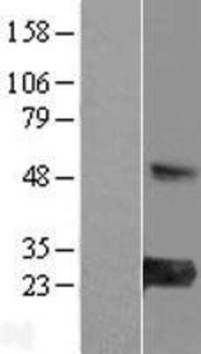 Western Blot: MED30 Overexpression Lysate (Adult Normal) [NBL1-12991] Left-Empty vector transfected control cell lysate (HEK293 cell lysate); Right -Over-expression Lysate for MED30.
