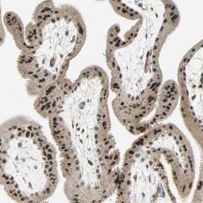 Immunohistochemistry-Paraffin: MED4 Antibody [NBP1-84977] - Staining of human Placenta shows strong nuclear positivity in trophoblastic cells.