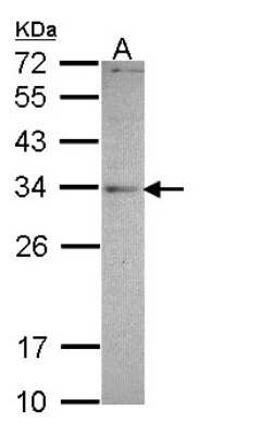 Western Blot: MED4 Antibody [NBP1-33671] - Sample (30 ug of whole cell lysate) A: A549 12% SDS PAGE; antibody diluted at 1:1000.
