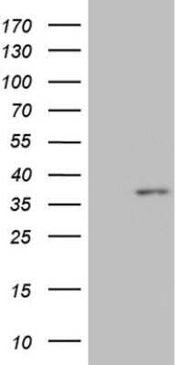 Western Blot: MED6 Antibody (3C9) [NBP2-45811] - Analysis of HEK293T cells were transfected with the pCMV6-ENTRY control (Left lane) or pCMV6-ENTRY MED6.