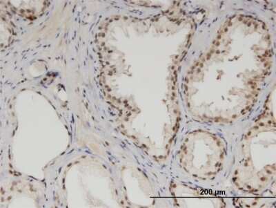 Immunohistochemistry-Paraffin: MED6 Antibody (4C2) [H00010001-M07] - Analysis of monoclonal antibody to MED6 on formalin-fixed paraffin-embedded human prostate. Antibody concentration 3 ug/ml