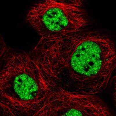 Immunocytochemistry/ Immunofluorescence MED6 Antibody