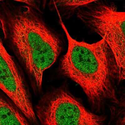 Immunocytochemistry/ Immunofluorescence MED6 Antibody