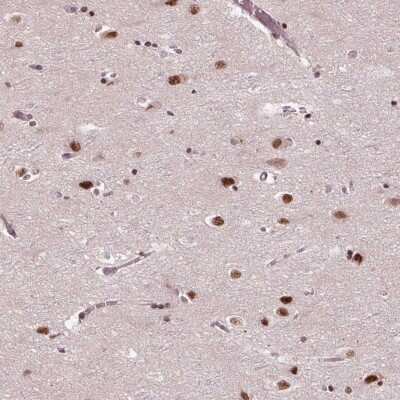 Immunohistochemistry-Paraffin: MED6 Antibody [NBP2-38118] - Staining of human cerebral cortex shows strong nuclear positivity in neuronal cells.