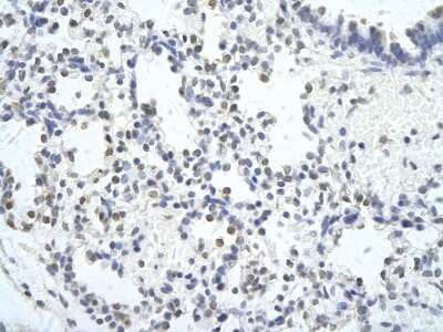 Immunohistochemistry: MED6 Antibody [NBP3-10484] - Immunohistochemical analysis of paraffin-embedded human lung cell tissue.