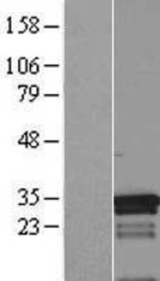 Western Blot: MED7 Overexpression Lysate (Adult Normal) [NBP2-08264] Left-Empty vector transfected control cell lysate (HEK293 cell lysate); Right -Over-expression Lysate for MED7.