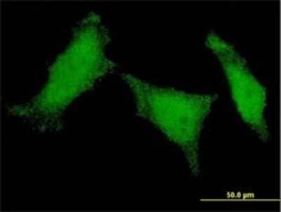 Immunocytochemistry/Immunofluorescence: MED8 Antibody (1D3) [H00112950-M01] - Analysis of monoclonal antibody to MED8 on HeLa cell . Antibody concentration 10 ug/ml.