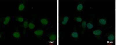 Immunocytochemistry/ Immunofluorescence MED8 Antibody