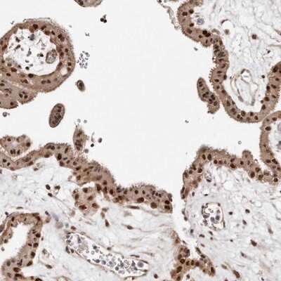 Immunohistochemistry-Paraffin: MED8 Antibody [NBP1-89015] - Staining of human placenta shows strong nuclear positivity in trophoblastic cells.