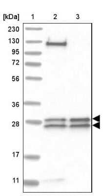 Western Blot: MED8 Antibody [NBP1-89015] - Lane 1: Marker  [kDa] 230, 130, 95, 72, 56, 36, 28, 17, 11.  Lane 2: Human cell line RT-4.  Lane 3: Human cell line U-251MG
