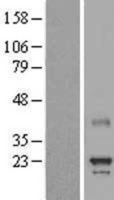 Western Blot MED8 Overexpression Lysate