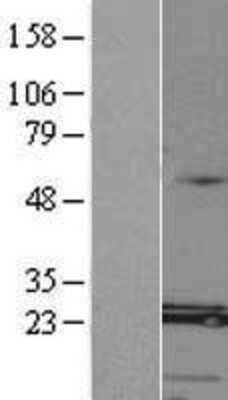 Western Blot: MED8 Overexpression Lysate (Adult Normal) [NBP2-08988] Left-Empty vector transfected control cell lysate (HEK293 cell lysate); Right -Over-expression Lysate for MED8.