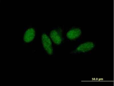 Immunocytochemistry/Immunofluorescence: MED9 Antibody [H00055090-B01P] - Analysis of purified antibody to MED9 on HeLa cell. (antibody concentration 10 ug/ml)