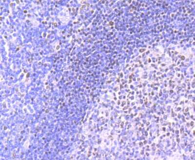 Immunohistochemistry-Paraffin: MEF2A Antibody (JA33-04) [NBP2-66943] - Analysis of paraffin-embedded human tonsil tissue using anti-MEF2A antibody. Counter stained with hematoxylin.