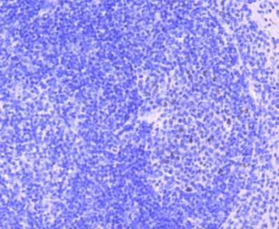 Immunohistochemistry-Paraffin: MEF2A Antibody (JA33-04) [NBP2-66943] - Analysis of paraffin-embedded mouse spleen tissue using anti-MEF2A antibody. Counter stained with hematoxylin.