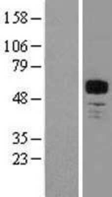 Western Blot MEF2A Overexpression Lysate