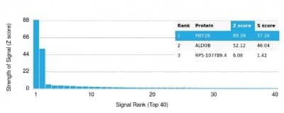 Protein Array: MEF2B Antibody (PCRP-MEF2B-2F9) - Azide and BSA Free [NBP3-14207] - Analysis of Protein Array containing more than 19,000 full-length human proteins using MEF2B Antibody (PCRP-MEF2B-2F9).