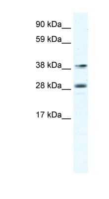 Western Blot: MEF2B Antibody [NBP1-80218] - Titration: 0.625ug/ml, Positive Control: Human Lymphnode.