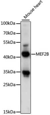 Western Blot: MEF2B Antibody [NBP3-03920] - Analysis of extracts of mouse heart, using MEF2B antibody at 1:1000 dilution. Secondary antibody: HRP Goat Anti-Rabbit IgG (H+L) at 1:10000 dilution. Lysates/proteins: 25ug per lane. Blocking buffer: 3% nonfat dry milk in TBST. Detection: ECL Basic Kit .