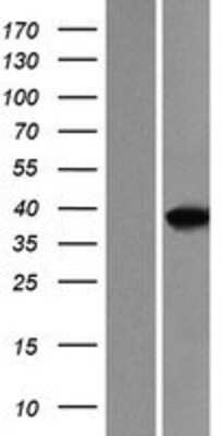 Western Blot MEF2B Overexpression Lysate