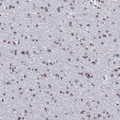 Immunohistochemistry-Paraffin: MEF2BNB Antibody [NBP2-47380] - Staining of human cerebral cortex shows granular cytoplasmic positivity in glia cells.