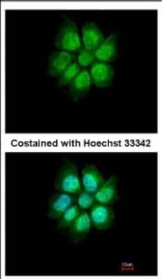 Immunocytochemistry/Immunofluorescence: MEFV Antibody [NBP2-17262] - Immunofluorescence analysis of paraformaldehyde-fixed A431, using antibody at 1:500 dilution.
