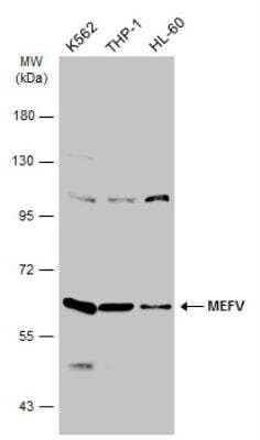 Western Blot: MEFV Antibody [NBP2-17262] - Various whole cell extracts (30 ug) were separated by 7.5% SDS-PAGE, and the membrane was blotted with MEFV antibody diluted at 1:1000. HRP-conjugated anti-rabbit IgG antibody was used to detect the primary antibody.
