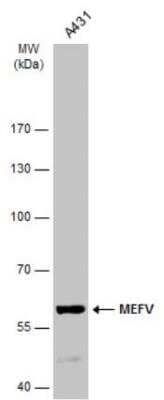 Western Blot: MEFV Antibody [NBP2-17262] - Whole cell extract (30 ug) was separated by 7.5% SDS-PAGE, and the membrane was blotted with MEFV antibody [N3C1], Internal diluted at 1:1000. The HRP-conjugated anti-rabbit IgG antibody (NBP2-19301) was used to detect the primary antibody.