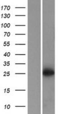 Western Blot: MEIR5 Overexpression Lysate (Adult Normal) [NBP2-05490] Left-Empty vector transfected control cell lysate (HEK293 cell lysate); Right -Over-expression Lysate for MEIR5.