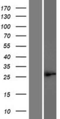 Western Blot: MEIR5 Overexpression Lysate (Adult Normal) [NBP2-08943] Left-Empty vector transfected control cell lysate (HEK293 cell lysate); Right -Over-expression Lysate for MEIR5.