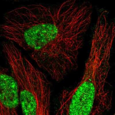 Immunocytochemistry/Immunofluorescence: MEIS1 Antibody [NBP2-54930] - Staining of human cell line HeLa shows localization to nucleoplasm.